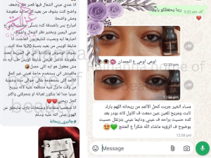 صورة توضح اراء العملاء وتجاربهم لكحل الأثمد