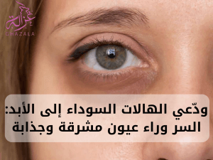 فتاة تعاني من الهالات السوداء تحت العين